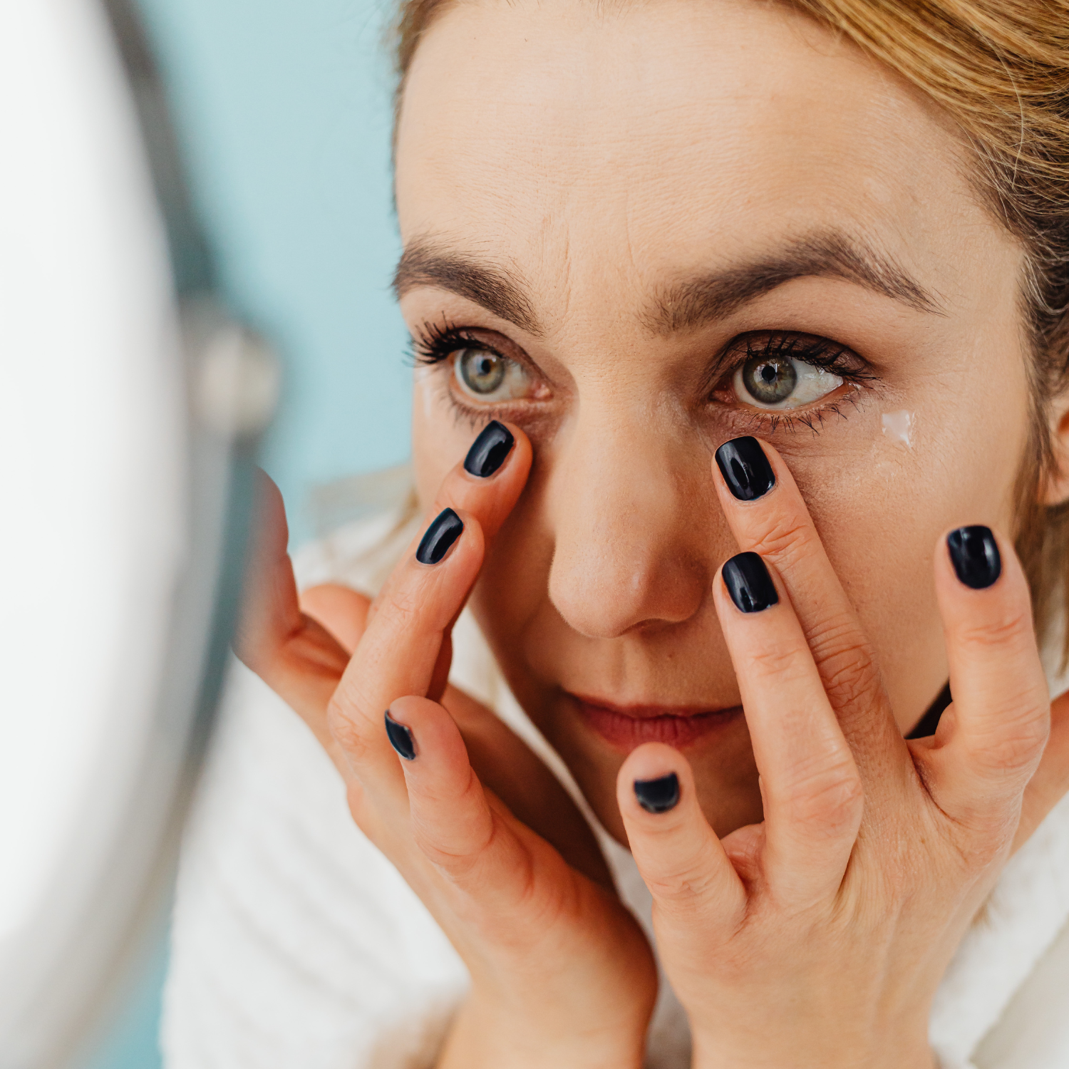 Can Dry Eyes Cause Dark Circles?